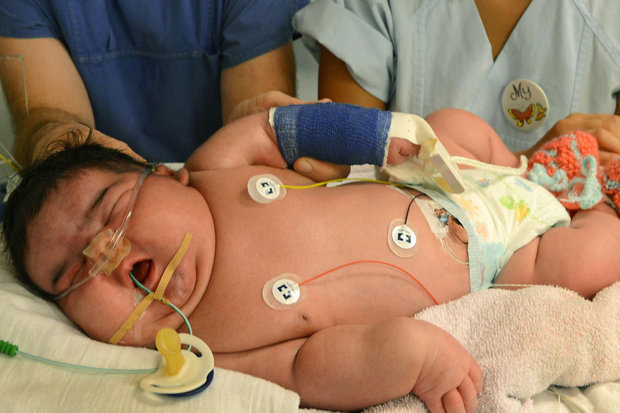 В Болгарии родился самый большой в мире малыш