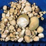 В Индии мужчине удалили рекордное количество камней в почках В Индии мужчине удалили рекордное количество камней в почках