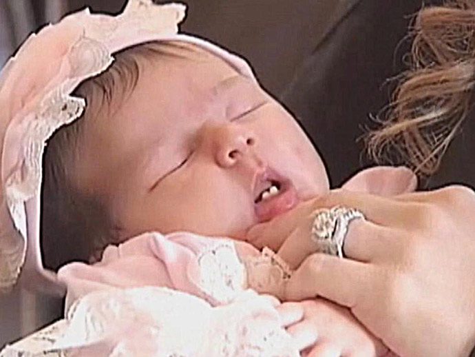 Самое большое количество зубов при рождении